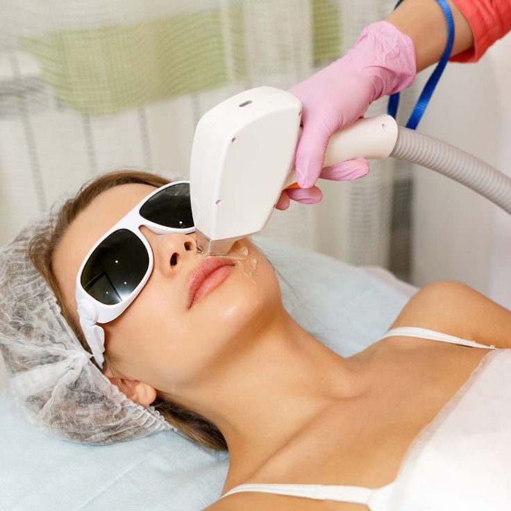 Laser Hair Removal Michigan